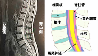 正常な脊柱管image